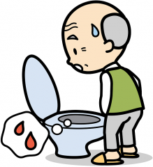 血尿 おしっこ 尿に血が混じる 埼玉県大宮駅と東京都上野駅の泌尿器科